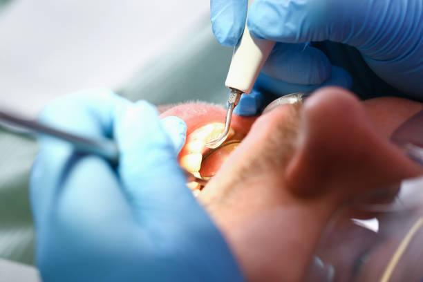 Best Emergency Gum Pain Relief  in Lochmoor Waterway Estates, FL
